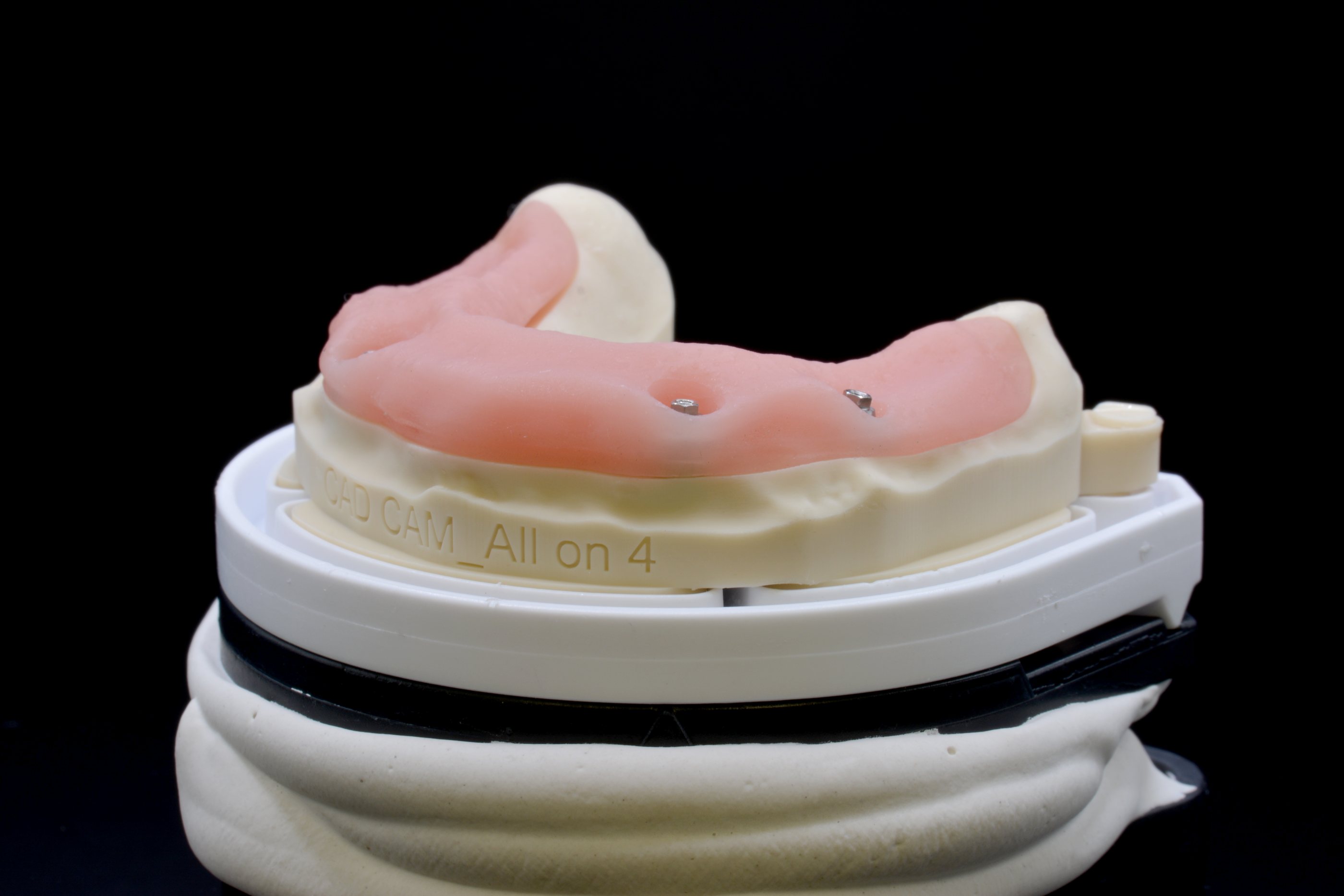 Gingiva-Basis mit Schraubenkanälen auf dem Modell