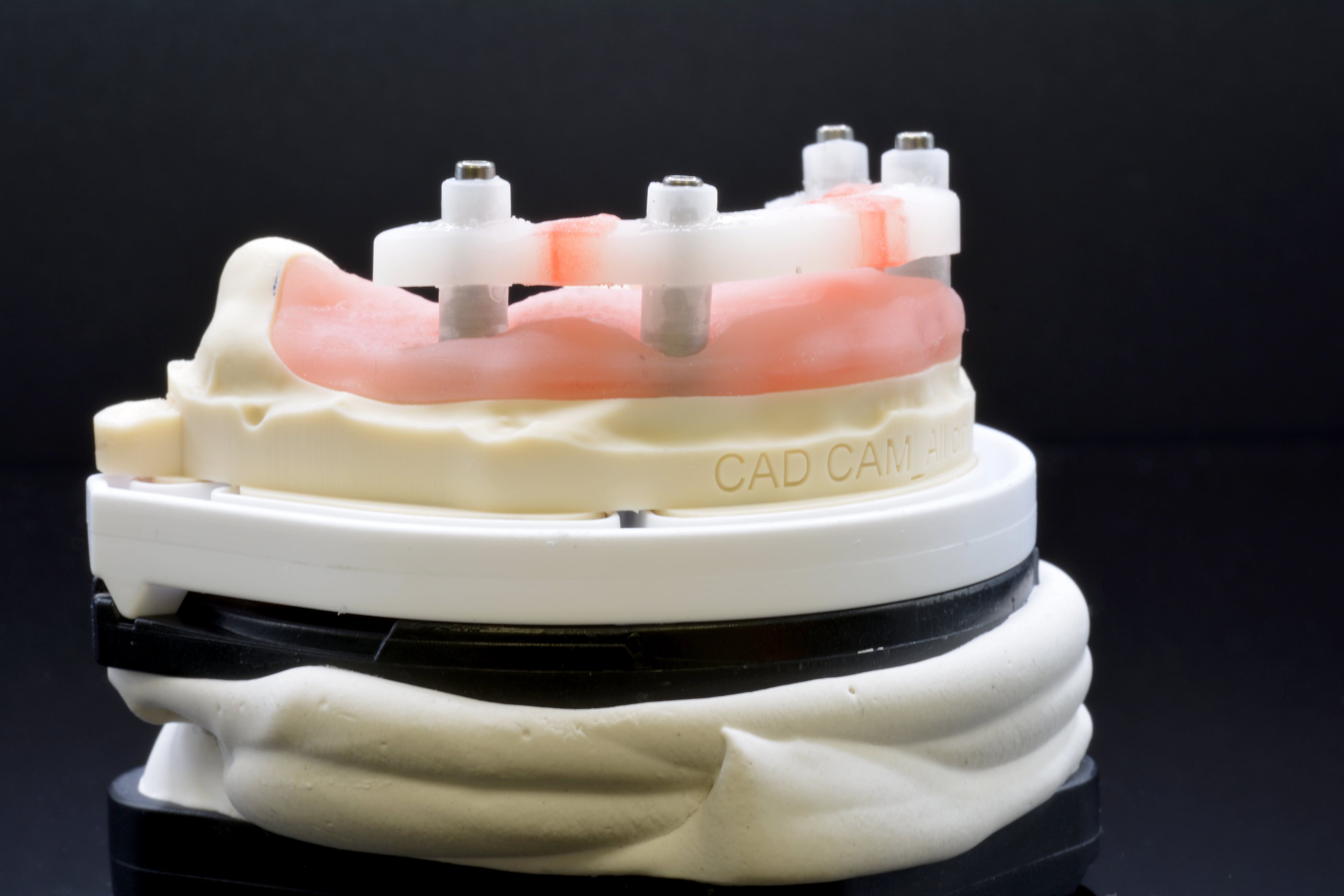Implantat-Transfer-Check auf dem Modell