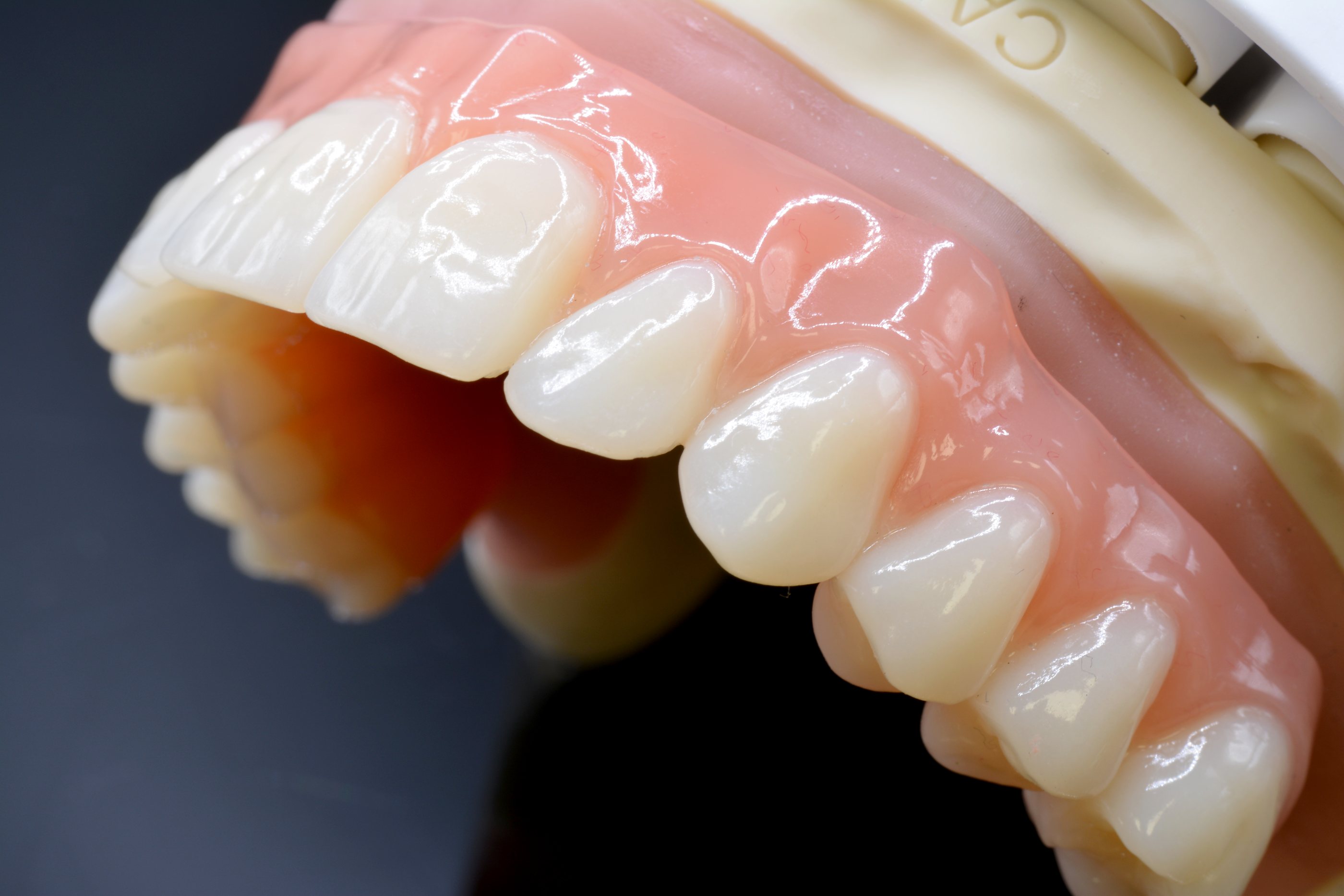 Detail: Zahnkranz und Gingiva